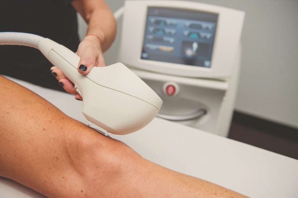 What Is IPL Hair Removal? British Institute of Lasers
