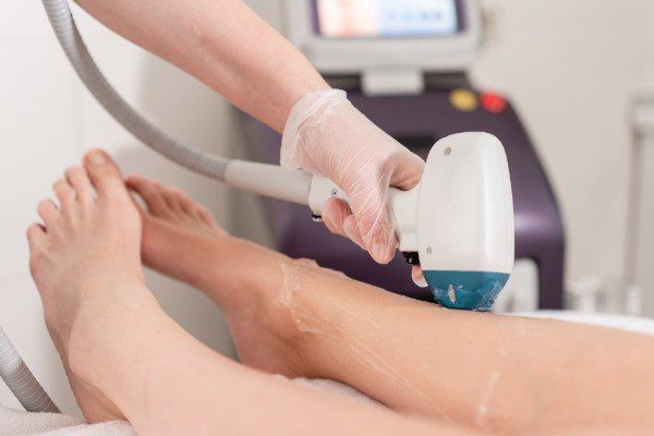 IPL Hair Removal Side Effects British Institute of Lasers