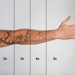 how effective is tattoo removal