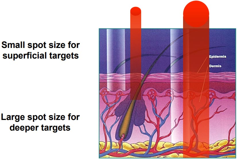 graphic-representation-of-laser-wavelength