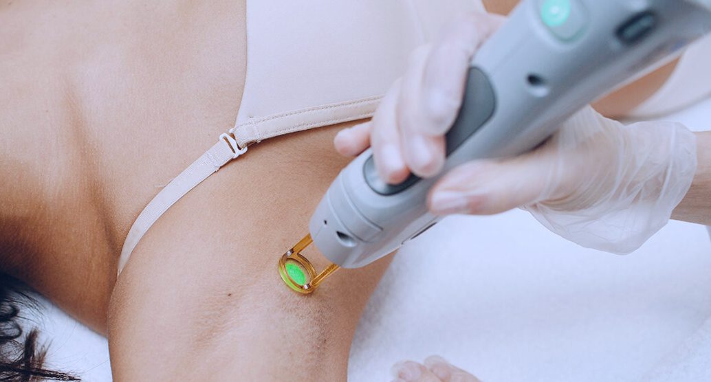 Is 6 Sessions of Laser Hair Removal Enough Expert Tips