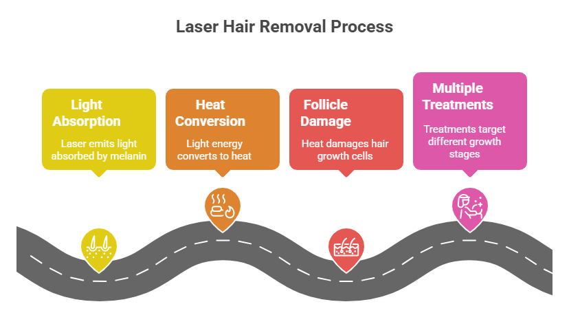 How laser hair removal works, simplified stages