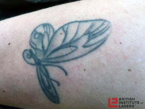 Butterfly Tattoo 1